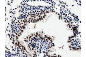 Image no. 2 for anti-5'-Nucleotidase Domain Containing 1 (NT5DC1) antibody (ABIN1499838)