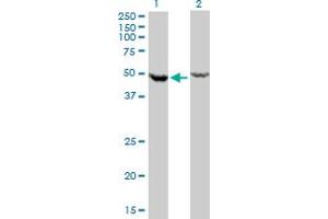 Western Blot analysis of DDX6 expression in transfected 293T cell line by DDX6 monoclonal antibody (M01), clone 3D2. (DDX6 anticorps  (AA 1-483))