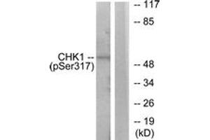 Western blot analysis of extracts from MCF7 cells, using Chk1 (Phospho-Ser317) Antibody. (CHEK1 anticorps  (pSer317))