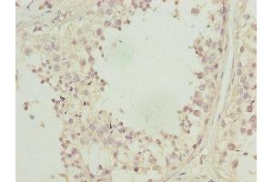 Immunohistochemistry of paraffin-embedded human testis tissue using ABIN7146719 at dilution of 1:100 (CA3 anticorps  (AA 2-260))