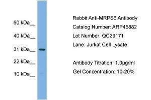 WB Suggested Anti-MRPS6  Antibody Titration: 0. (MRPS6 anticorps  (C-Term))