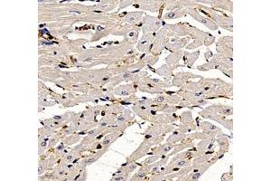 Immunohistochemistry of paraffin embedded rat heart using ANXA3 (ABIN7073065) at dilution of 1: 300 (400x lens)