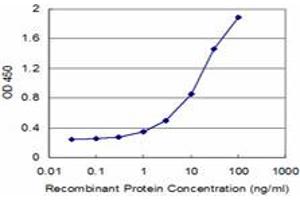 Detection limit for recombinant GST tagged LMX1B is approximately 0.
