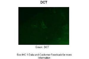 Sample Type :  Zebrafish embryo section  Primary Antibody Dilution :  1:50  Secondary Antibody :  Anti-rabbit-Alexa Fluor 488  Secondary Antibody Dilution :  1:500  Color/Signal Descriptions :  Green: DCT  Gene Name :  Dct  Submitted by :  Anonymous (DCT anticorps  (Middle Region))
