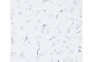 Immunohistochemistry of paraffin-embedded Rat brain endothelial cells using P Glycoprotein Polyclonal Antibody at dilution of 1:100 (40x lens). (P-Glycoprotein anticorps)