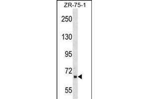 WD1 Antibody (Center) (ABIN1538147 and ABIN2849315) western blot analysis in ZR-75-1 cell line lysates (35 μg/lane). (PPWD1 anticorps  (AA 236-262))