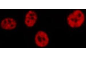 ABIN6267309 staining HeLa by IF/ICC. (C-JUN anticorps  (pSer73))