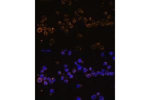 Immunofluorescence analysis of Jurkat cells using KLRC4 Polyclonal Antibody (ABIN7268115) at dilution of 1:100 (40x lens).