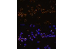 Immunofluorescence analysis of Jurkat cells using KLRC4 Polyclonal Antibody (ABIN7268115) at dilution of 1:100 (40x lens). (KLRC4 anticorps  (AA 1-55))