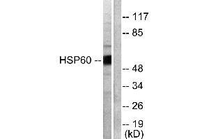 Western blot analysis of extracts from COLO205 cells, using HSP60 antibody (#C0233). (HSPD1 anticorps)