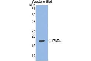 Western blot analysis of the recombinant protein. (SEMA3F anticorps  (AA 604-785))