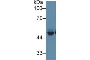 Western blot analysis of Mouse Cerebrum lysate, using Mouse PICK1 Antibody (1 µg/ml) and HRP-conjugated Goat Anti-Rabbit antibody ( (PICK1 anticorps  (AA 24-229))