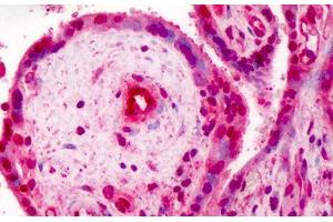 Human Placenta: Formalin-Fixed, Paraffin-Embedded (FFPE) (RBX1 anticorps  (C-Term))