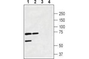 Western blot analysis of rat brain membrane (lanes 1 and 3) and mouse brain lysate (lanes 2 and 4): - 1,2. (Calcitonin Receptor anticorps  (1st Extracellular Loop))