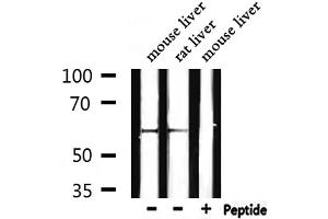 Western blot analysis of extracts from mouse liver,rat liver, using Catalase Antibody. (Catalase anticorps)