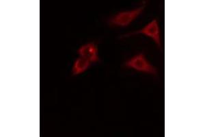 ABIN6274793 staining HT29 cells by IF/ICC. (ABHD8 anticorps  (Internal Region))