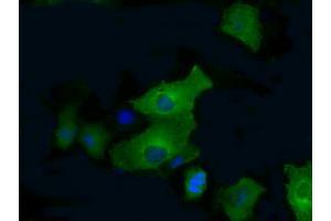 Anti-PFKFB4 mouse monoclonal antibody (ABIN2453452) immunofluorescent staining of COS7 cells transiently transfected by pCMV6-ENTRY PFKFB4 (RC201573).