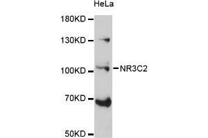 Western blot analysis of extracts of HeLa cells, using NR3C2 antibody (ABIN5971700) at 1:3000 dilution. (NR3C2 anticorps)
