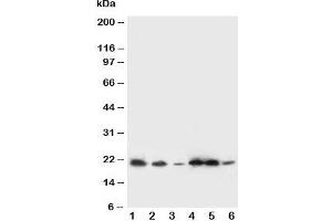 Western blot testing of SSR3 antibody and Lane 1:  rat liver;  2: rat spleen; and human samples 3: A431;  4: HeLa;  5: U87;  6: SMMC-7721 cell lysate.