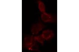 ABIN6267607 staining HepG2 by IF/ICC.