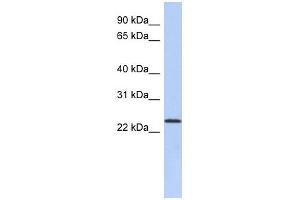 ULBP1 antibody used at 1 ug/ml to detect target protein. (ULBP1 anticorps  (N-Term))