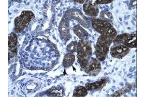 Image no. 1 for anti-GC-Rich Promoter Binding Protein 1 (GPBP1) (AA 67-116) antibody (ABIN6736275)