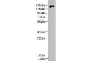 Western Blot All lanes: UBR2 antibody at 3 μg/mL + Mouse liver tissue Secondary Goat polyclonal to rabbit IgG at 1/10000 dilution Predicted band size: 201, 50, 67 kDa Observed band size: 201 kDa (UBR2 anticorps  (AA 101-439))