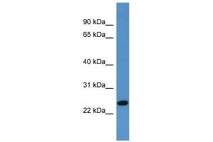 TP53INP1 antibody used at 0. (TP53INP1 anticorps  (C-Term))