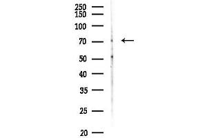 Western blot analysis of lysates from HUVEC cells(heat-shock, 45 min treatment), using SLC28 Antibody at 1/1000 dilution.