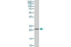 DHFR monoclonal antibody (M01), clone 2B10.