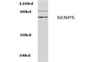 Image no. 1 for anti-SUMO1/sentrin Specific Peptidase 5 (SENP5) antibody (ABIN271958) (SENP5 anticorps)