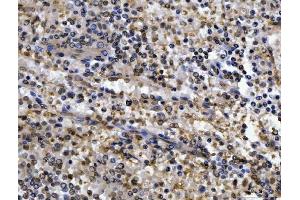 IHC analysis of CEP250 using anti-CEP250 antibody (ABIN7602053). (CEP250 anticorps  (AA 563-853))
