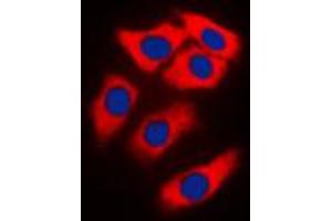 anti-Neuralized Homolog (Drosophila) (NEURL) (Center) antibody