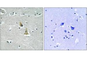 Immunohistochemistry analysis of paraffin-embedded human brain tissue, using p47 phox (Ab-345) Antibody. (NCF1 anticorps  (AA 311-360))