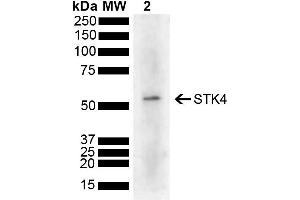 Western blot analysis of Human Cervical cancer cell line (HeLa) lysate showing detection of 55. (STK4 anticorps  (AA 320-420) (HRP))