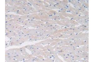 IHC-P analysis of Rat Heart Tissue, with DAB staining. (Cholecystokinin anticorps  (AA 1-115))