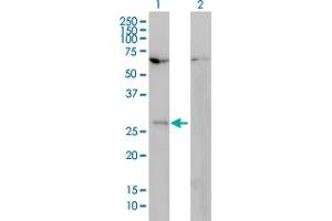 Western Blot analysis of HOXB7 expression in transfected 293T cell line by HOXB7 monoclonal antibody (M01), clone 4F9. (HOXB7 anticorps  (AA 55-120))