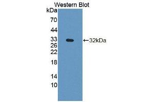 Western blot analysis of the recombinant protein. (Phospholipase C beta 4 anticorps  (AA 2-250))