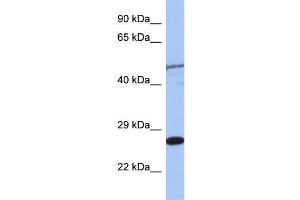 WB Suggested Anti-MIS12  Antibody Titration: 0. (MIS12 anticorps  (Middle Region))