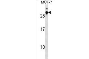 Western Blotting (WB) image for anti-Microvascular Endothelial Differentiation Gene 1 Protein (DNAJB9) antibody (ABIN2999789) (DNAJB9 anticorps)