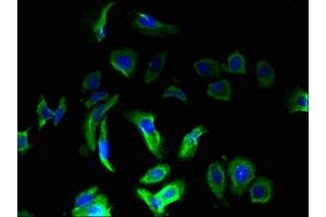 Immunofluorescence staining of MCF-7 cells with ABIN7159465 at 1:133, counter-stained with DAPI.