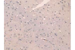 IHC-P analysis of Mouse Brain Tissue, with DAB staining. (SCGN anticorps  (AA 1-276))