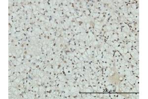Image no. 1 for anti-Androgen Receptor (AR) (AA 221-321) antibody (ABIN598541) (Androgen Receptor anticorps  (AA 221-321))