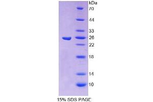 SDS-PAGE analysis of Human CBFb Protein. (CBFB Protéine)