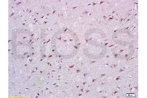 Formalin-fixed and paraffin embedded rat brain tissue labeled with Anti-Cathepsin B Polyclonal Antibody, Unconjugated (ABIN687412) at 1:200 followed by conjugation to the secondary antibody, (SP-0023), and DAB staining (Cathepsin B anticorps  (AA 251-339))