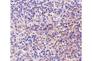 Immunohistochemistry (IHC) image for anti-CD180 Molecule (CD180) (C-Term) antibody (ABIN1030626) (CD180 anticorps  (C-Term))