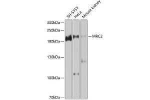 Western blot analysis of extracts of various cell lines, using MRC2 antibody (ABIN6129049, ABIN6143990, ABIN6143991 and ABIN6225189) at 1:1000 dilution.