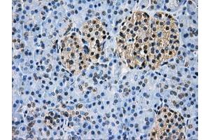 Image no. 7 for anti-Glucan (1,4-alpha-), Branching Enzyme 1 (GBE1) antibody (ABIN1498396)