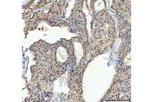 IHC analysis of TRPS1 using anti-TRPS1 antibody (ABIN7601443).