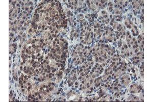 Image no. 8 for anti-Tryptophan 2,3-Dioxygenase (TDO2) antibody (ABIN1501352)